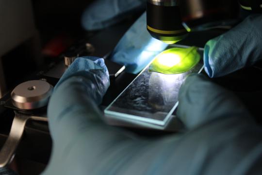 Blood Stem Cells Remember Every Infection, Study Finds