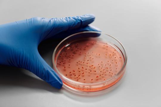 Sukunaarchaeum genome is the smallest ever found in a living cell