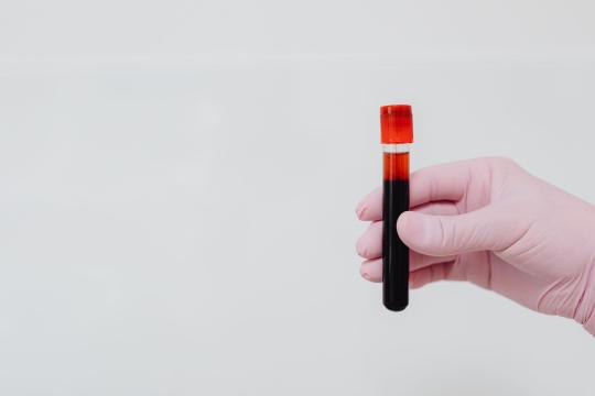 20-Minute STI Tests Could End Australia's Days-Long Wait