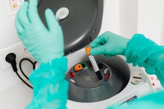 AI Blood Test Dementia Detection: One Sample Spots 5 Brain Diseases
