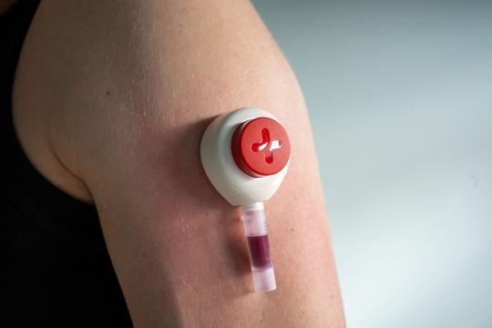 Glucose Monitors Cut Blood Sugar for Non-Insulin Diabetics