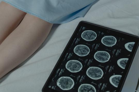 New global dementia incidence data: new cases on track to double