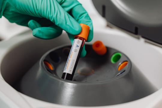 Multi-Cancer Early Detection Test Earns FDA Breakthrough Status