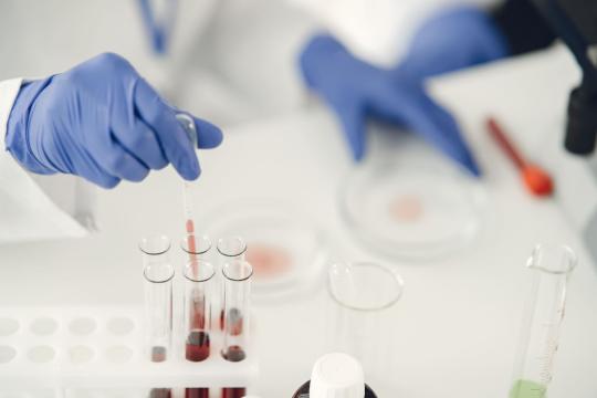A Lung Cancer Blood Test Could Flag Risk a Decade Early