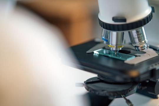 Asgard Archaea Can Crawl: New Clue to the Origin of Complex Life