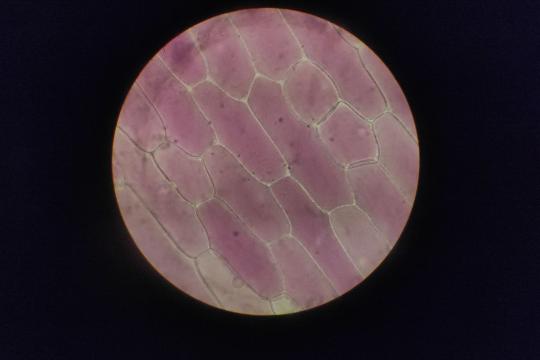 Brown Fat Study: 100,000 Scans Link It to Better Mood