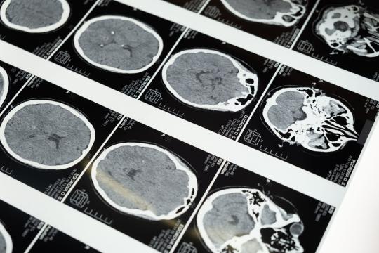 Ten Thousand Teen Brains Just Became an Open Book for Science