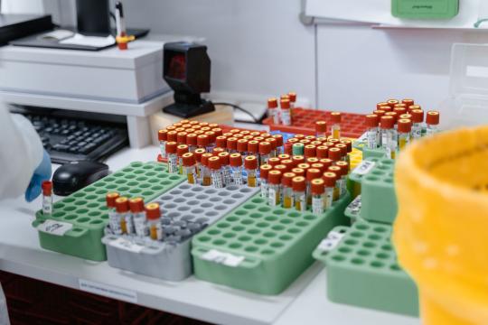 A Decade Before Diagnosis, IBD Leaves Clues in Blood