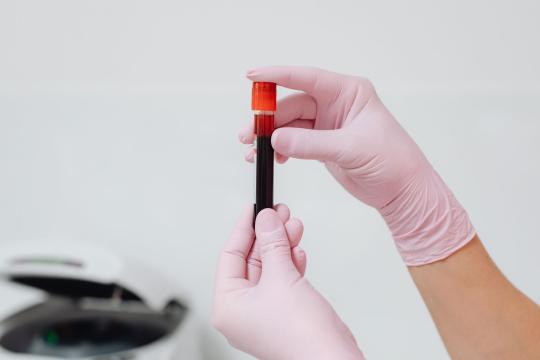 HIV Testing Gaps Are Letting Australia Down, Study Warns
