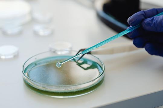 CBD Cooled Brain Inflammation in Lab-Grown Human Cells