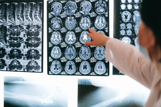 Teen Anxiety Brain Circuits Mapped in New Neuroscience Study