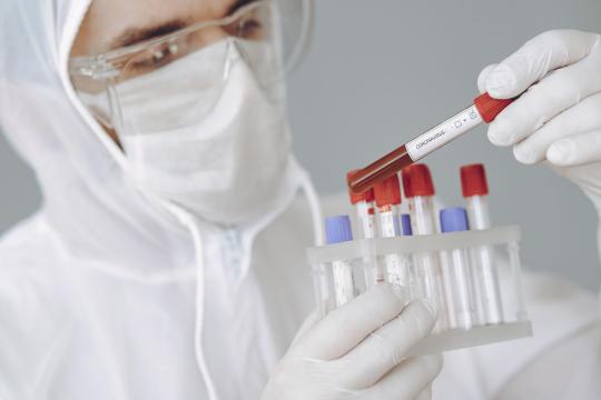 Scientists Built a Sleep Deprivation Test Out of Spit