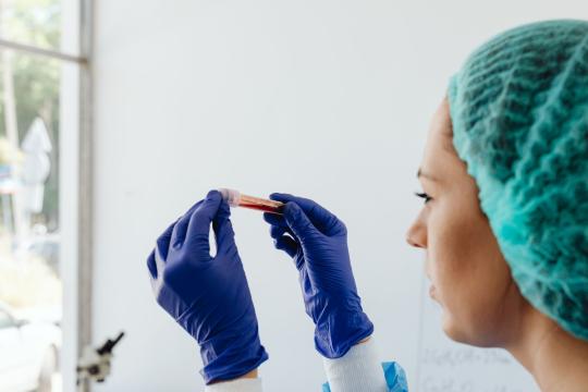 New PANXEON Blood Test Catches Pancreatic Cancer Early