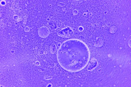 MIT's New Microscope Films Neurons Firing Live