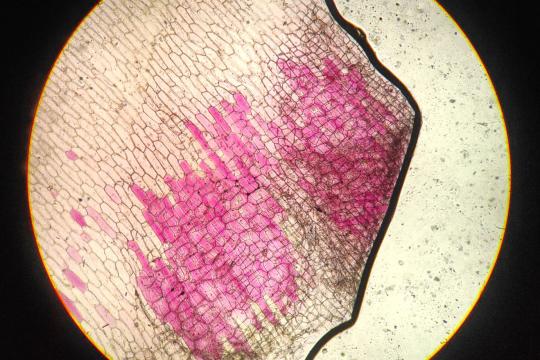 Squeezed to Death: The Pressure That Stops Cancer Cells