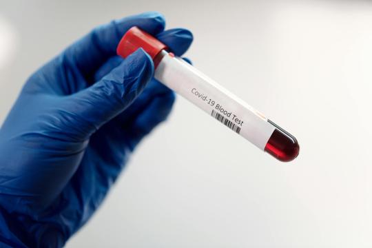 UTI Test Same Day: New Diagnostic Delivers 97% Accurate Results