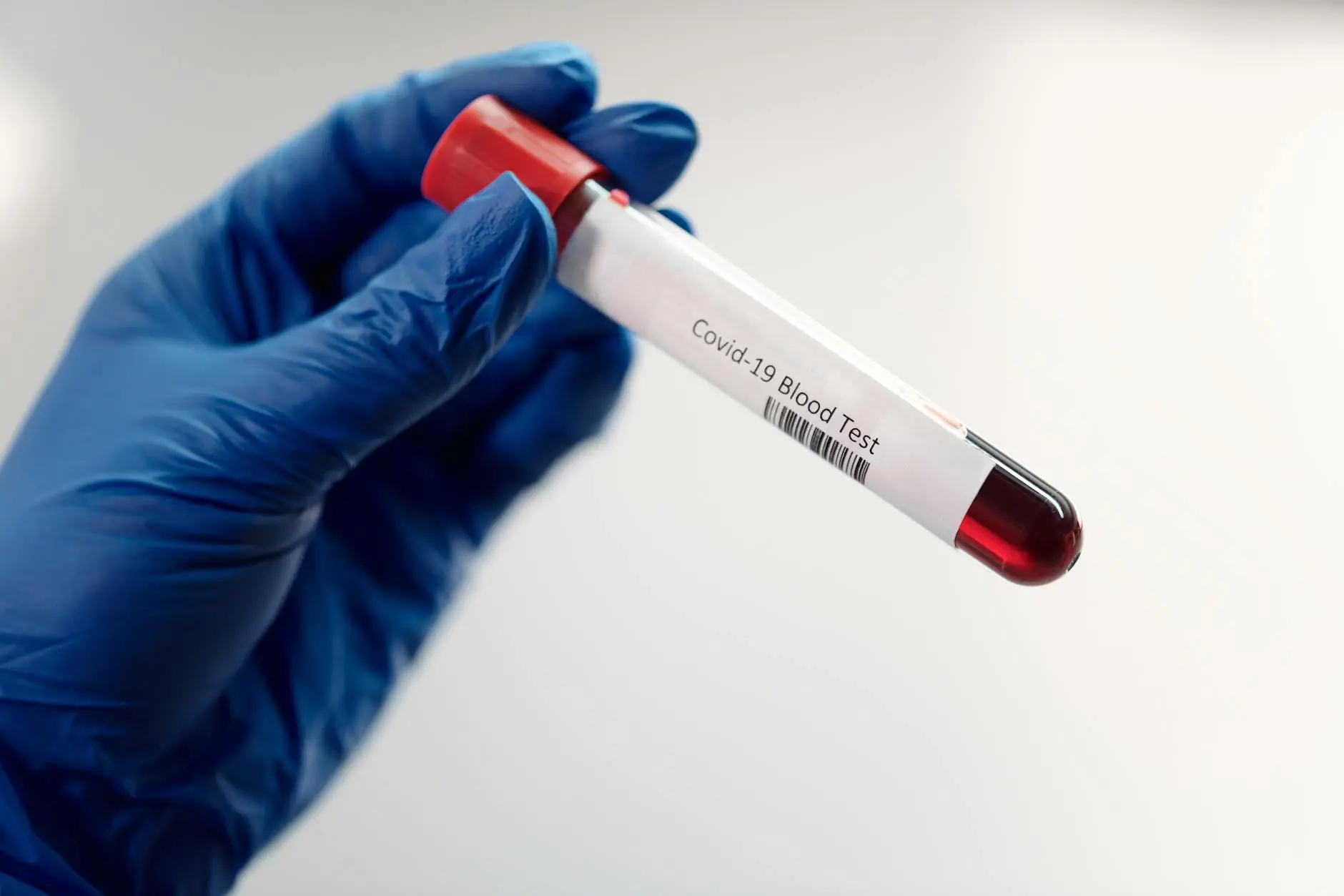 UTI Test Same Day: New Diagnostic Delivers 97% Accurate Results